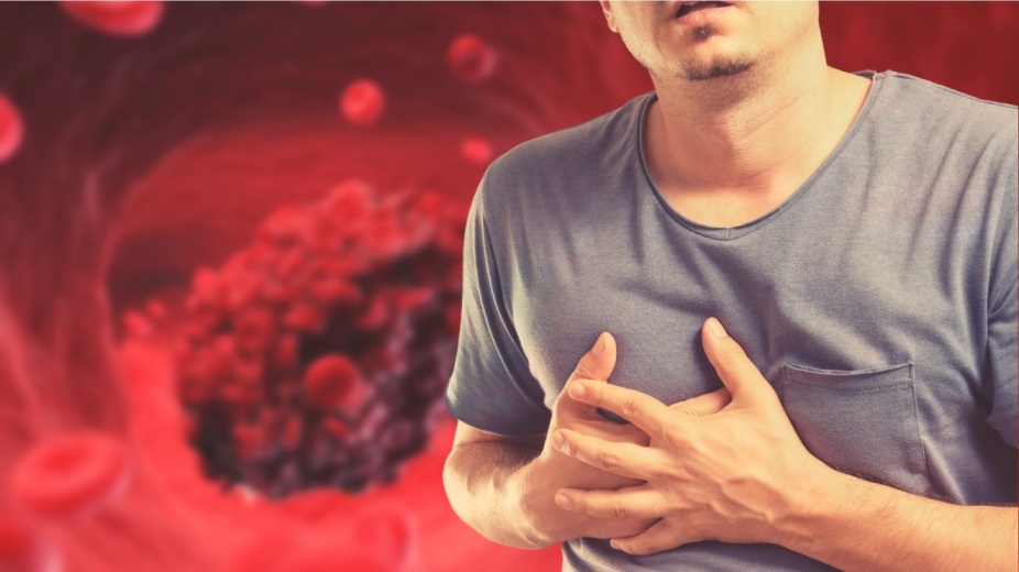 Pulmonary Embolism, Causes, Symptoms and Treatment
